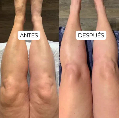 Dile Adiós a la inflamación crónica con Drenaje Linfático natural