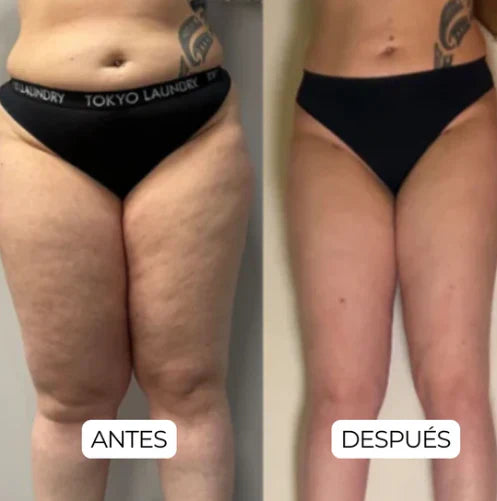 Dile Adiós a la inflamación crónica con Drenaje Linfático natural
